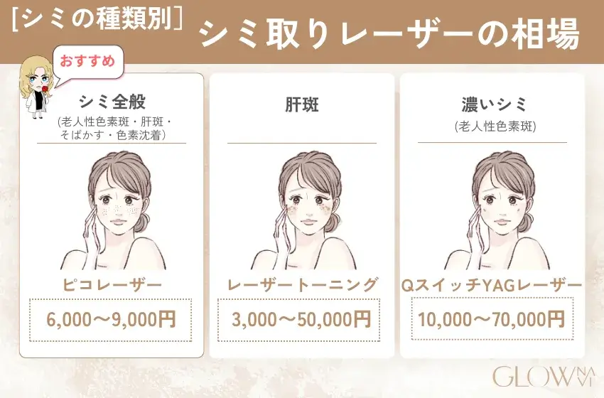 シミ取りレーザー機器(シミ別)料金相場