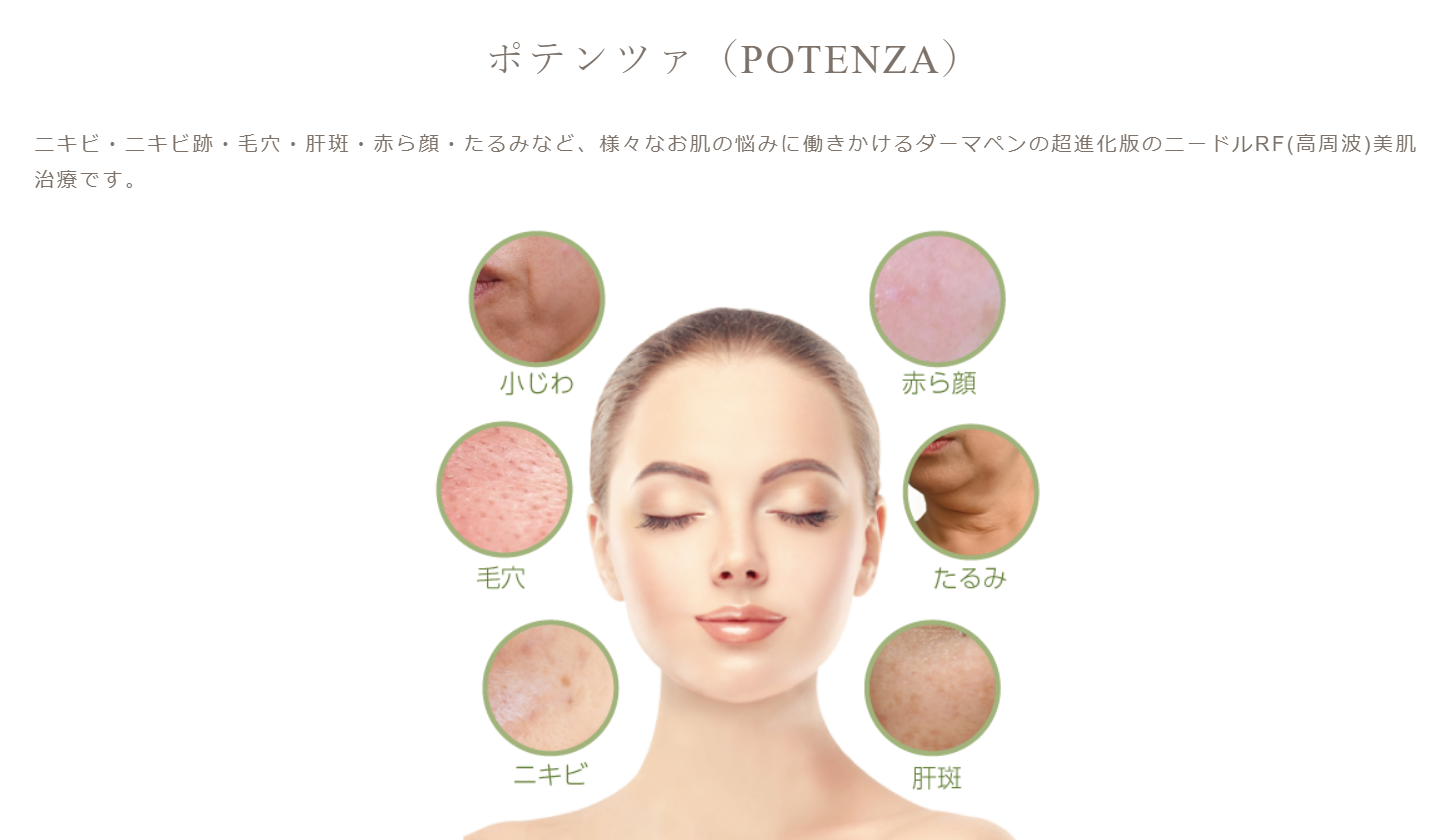 ポテンツァ（毛穴や肝斑など3種類のモードから選択）全顔※初診料込 東京でポテンツァが安いおすすめクリニック12選！費用相場も解説