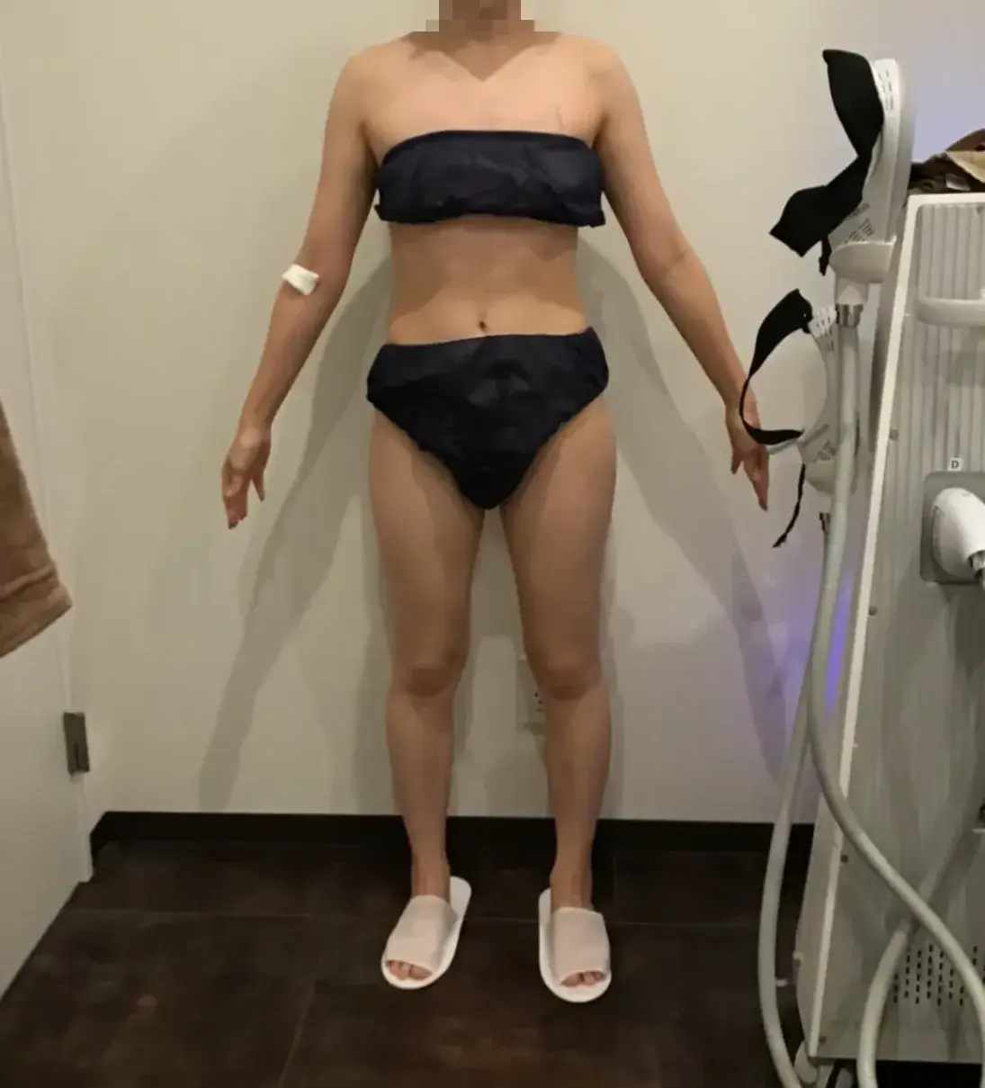 URARAクリニック　医療痩身　After画像