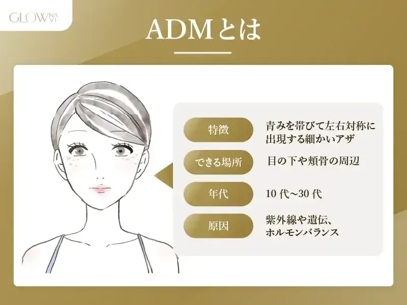 ADMとは