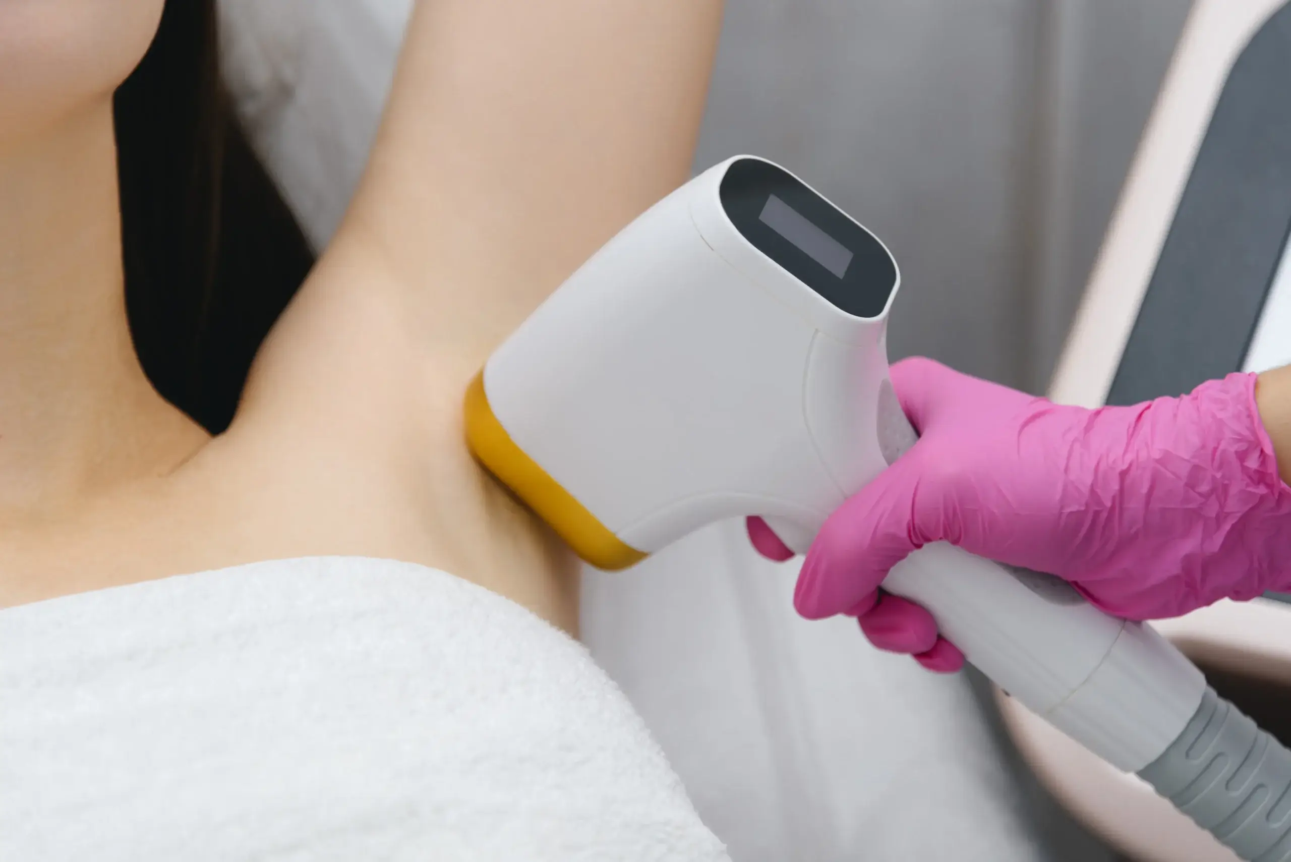 ワキ ミラドライ