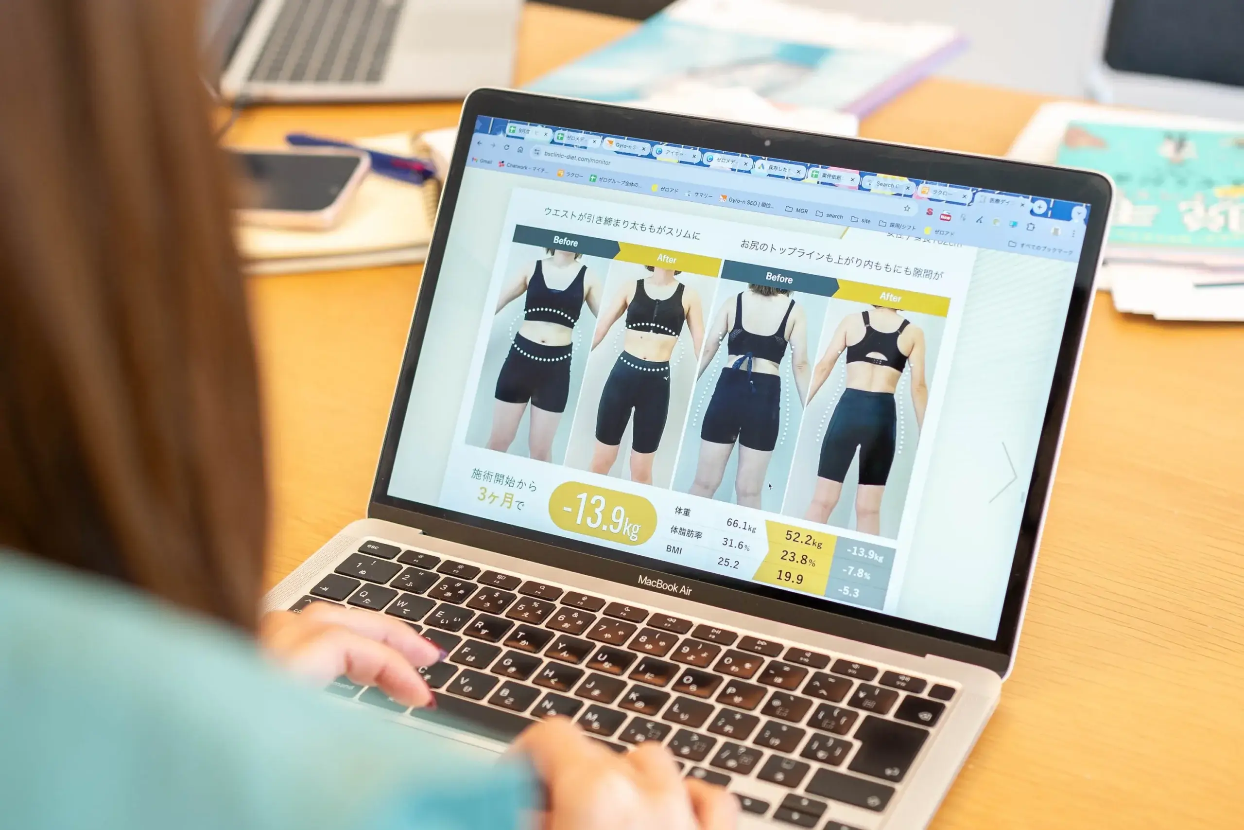 医療痩身クリニックのメニュー検証