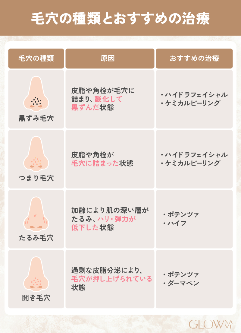毛穴治療 おすすめ