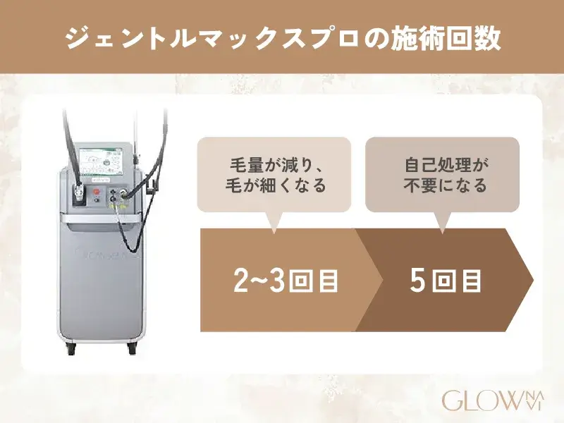 ジェントルマックスプロ