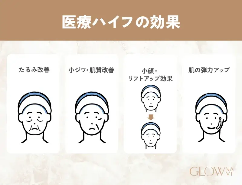 ハイフHIFUで期待できる効果は？　解説画像