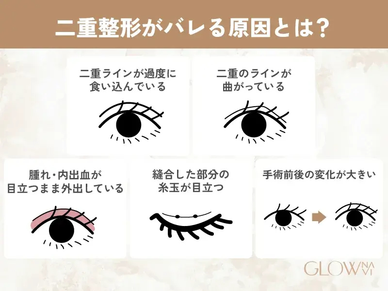 二重整形　おすすめ