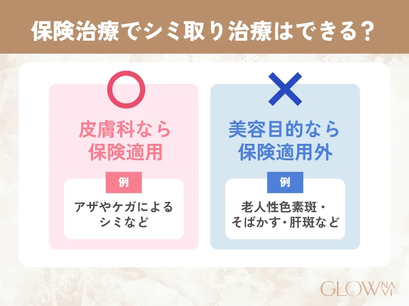 シミ取りレーザー　料金相場