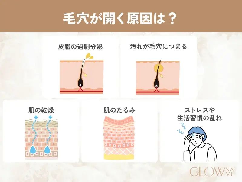 毛穴が開く原因