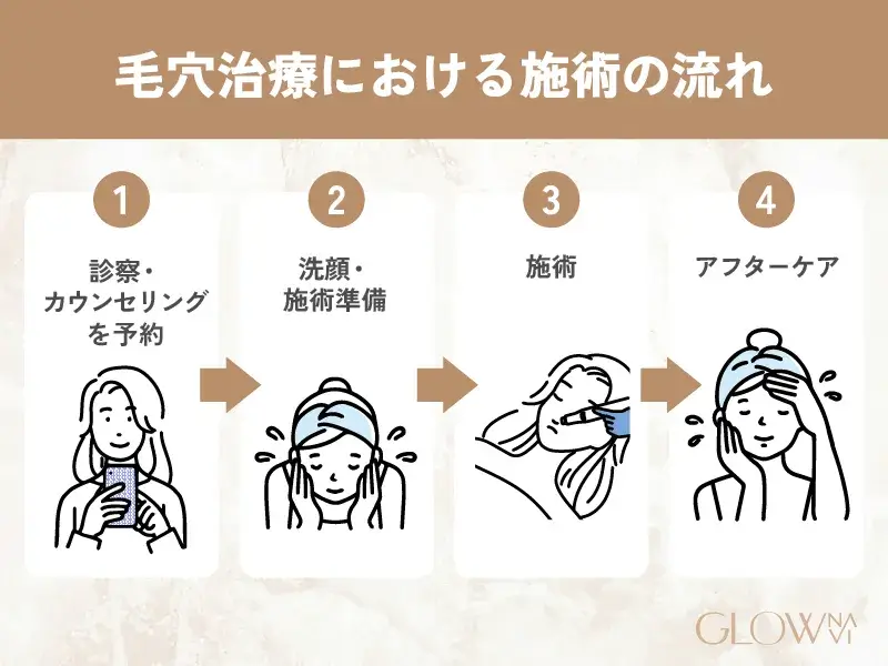 毛穴治療における施術の流れ