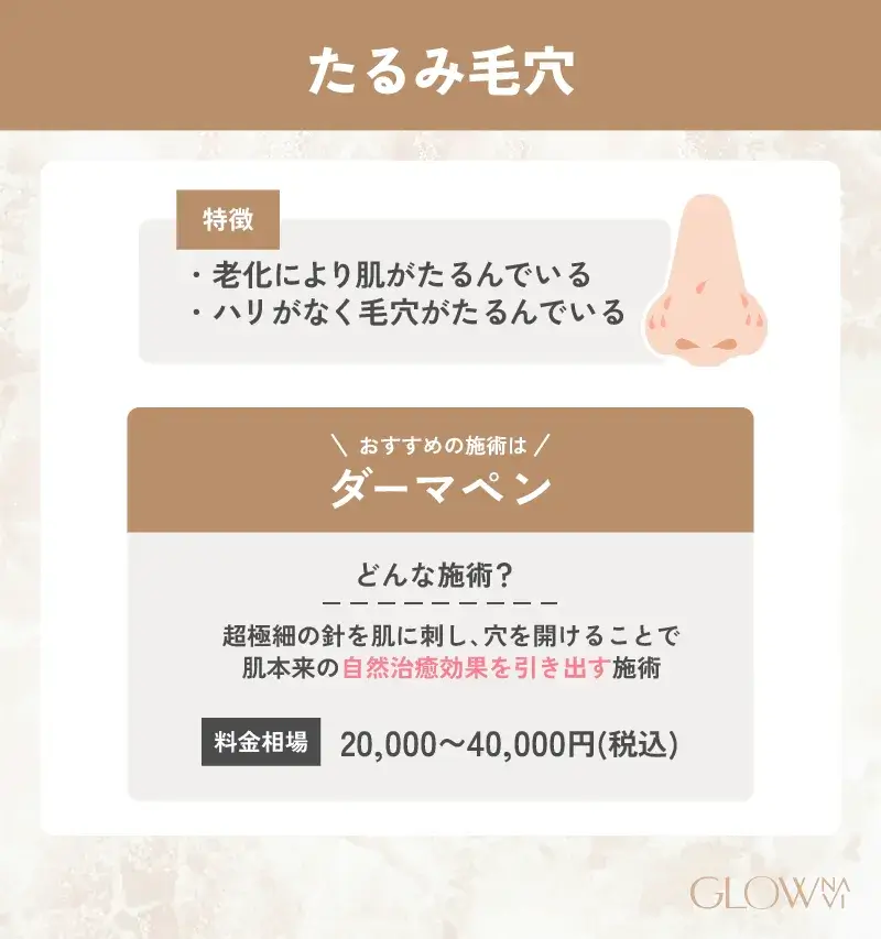 毛穴治療　おすすめ