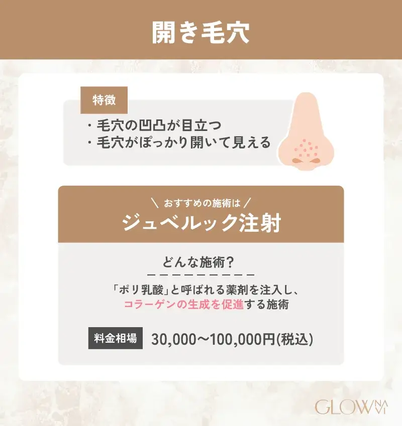 毛穴治療　おすすめ