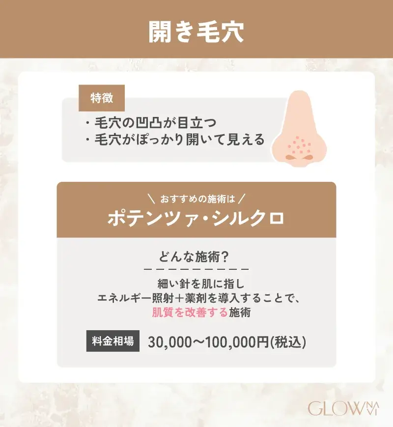 毛穴治療　おすすめ