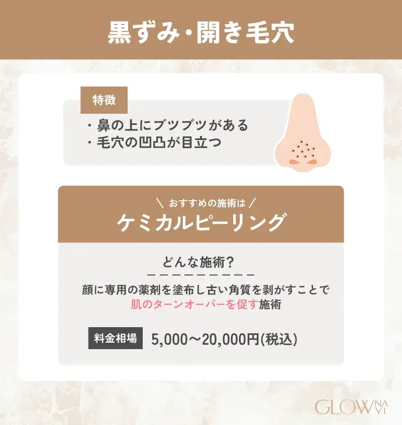 毛穴治療　おすすめ