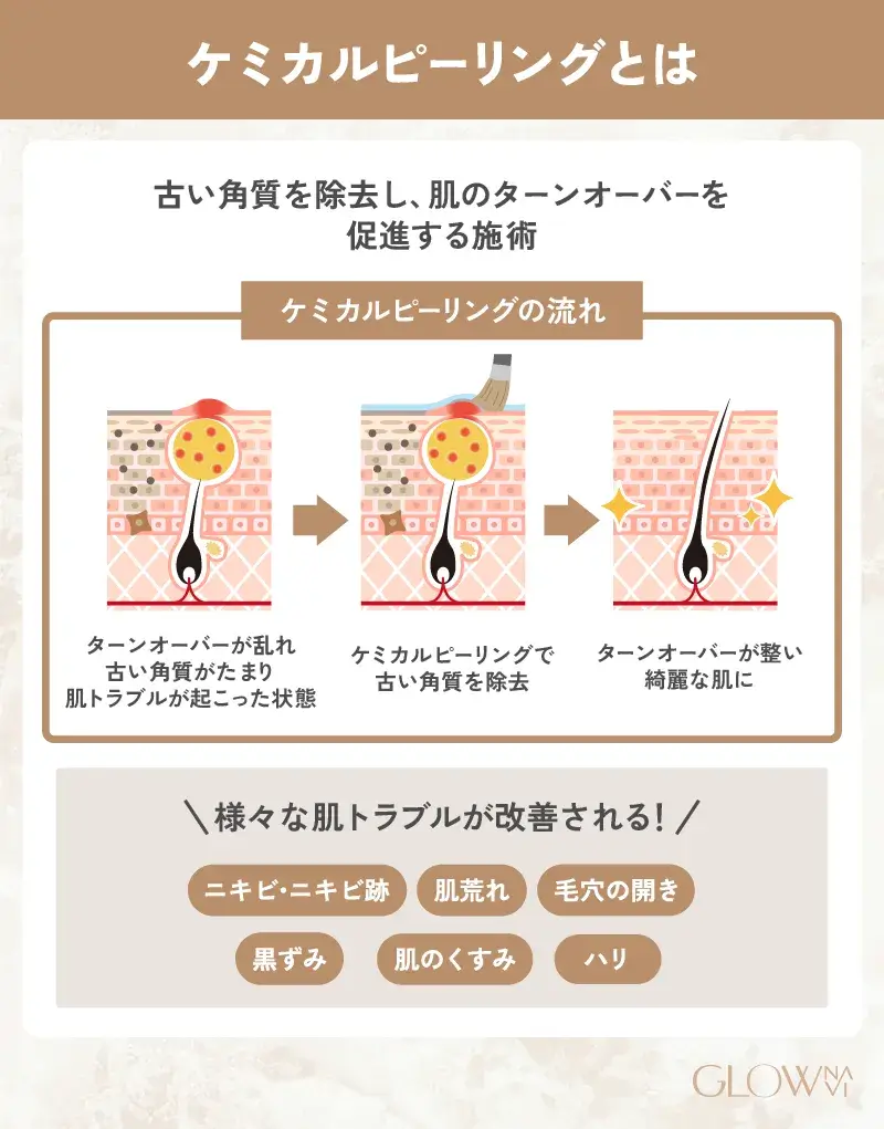 ケミカルピーリングとは「新しい肌の再生を促す」施術　解説画像