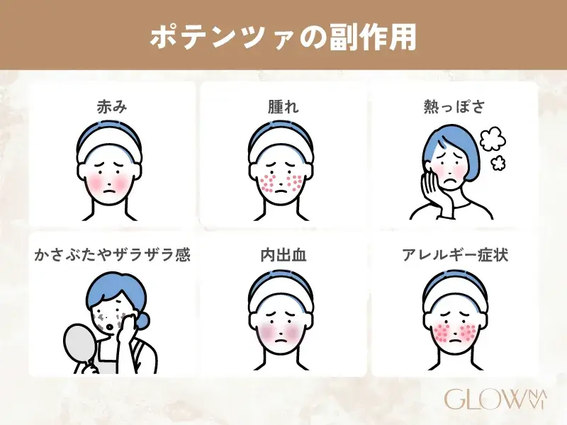 ポテンツァ　おすすめ