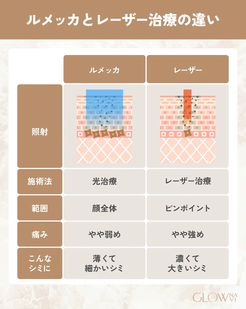 ルメッカとレーザー治療の違いについての解説画像