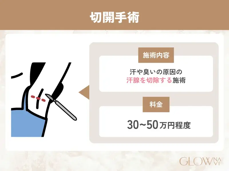 ワキガ治療 切開手術