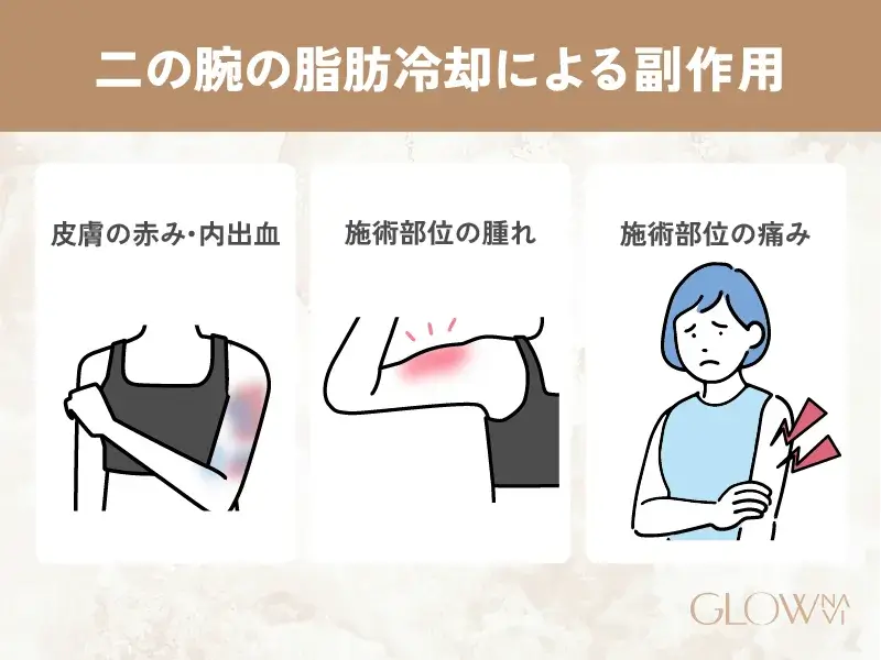 脂肪冷却 副作用