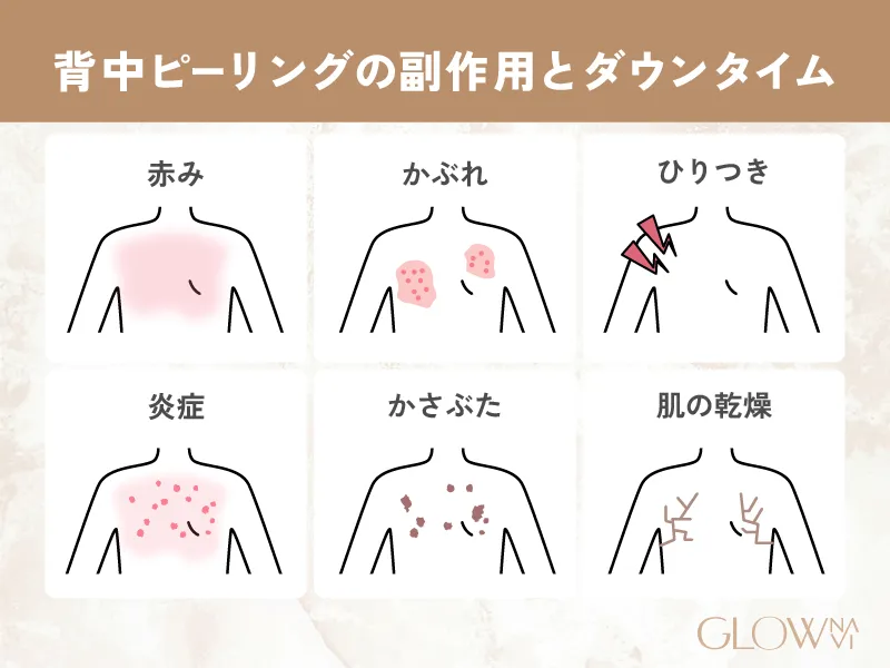 背中のケミカルピーリングの副作用とダウンタイムの参考画像