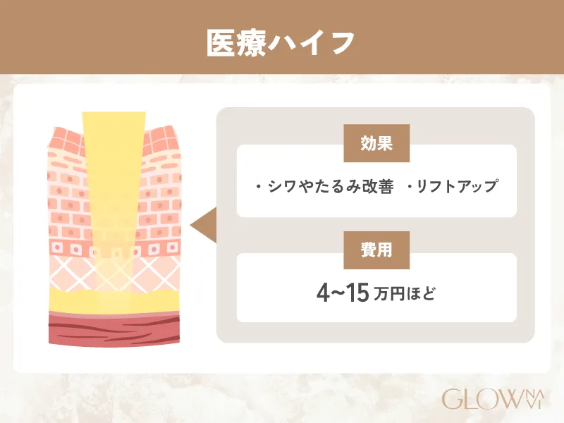 医療ハイフ　紹介画像