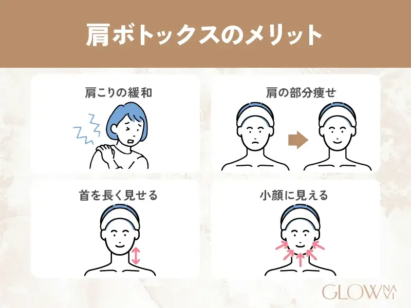 肩ボトックスのメリット