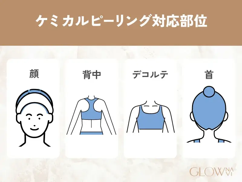 ケミカルピーリング　大阪