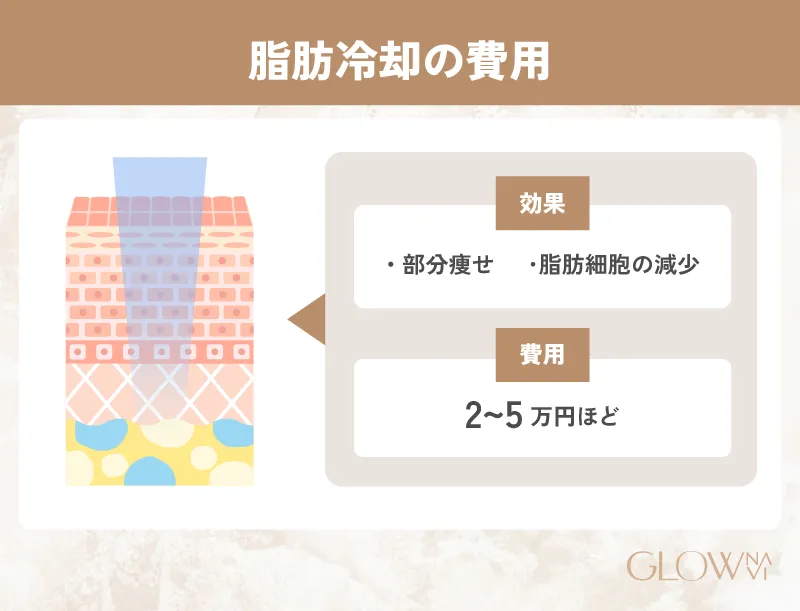 脂肪冷却の費用　紹介画像