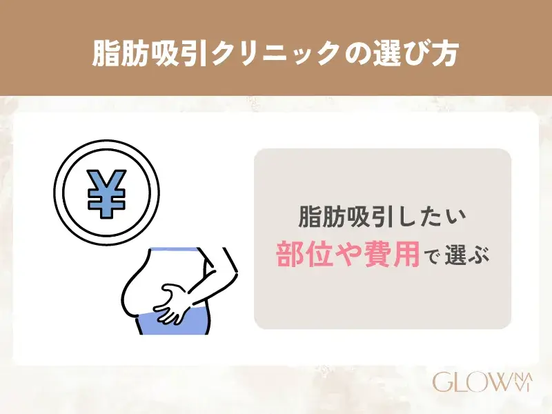 脂肪吸引　おすすめ