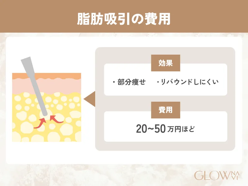 脂肪吸引の費用　紹介画像