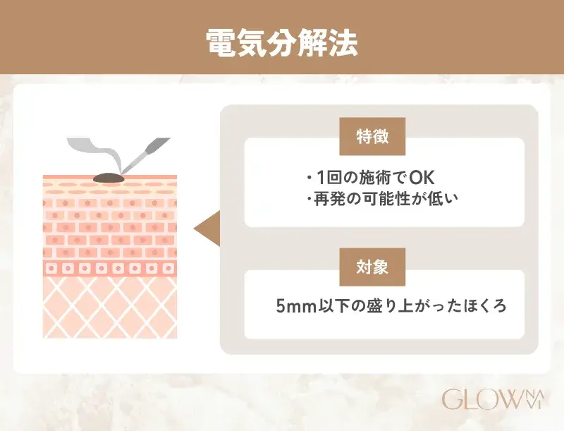 ほくろ除去　おすすめ