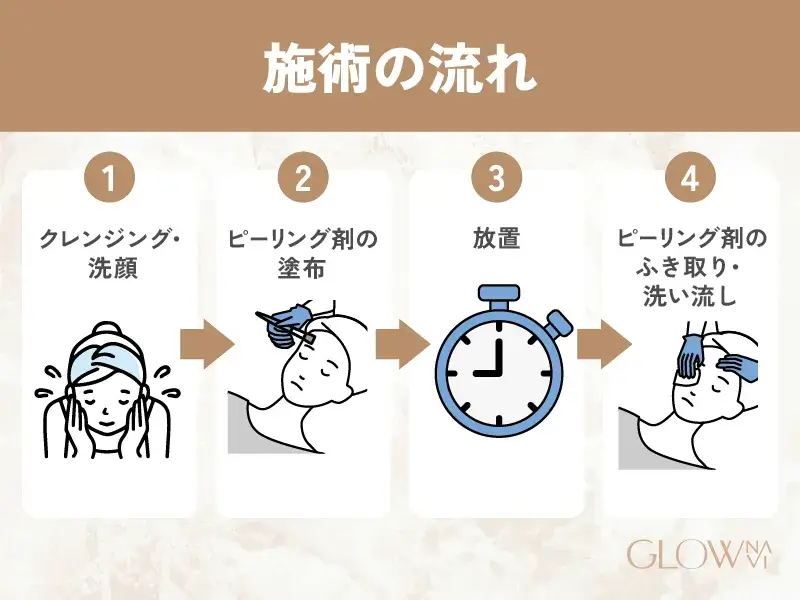 施術当日の流れ 解説画像