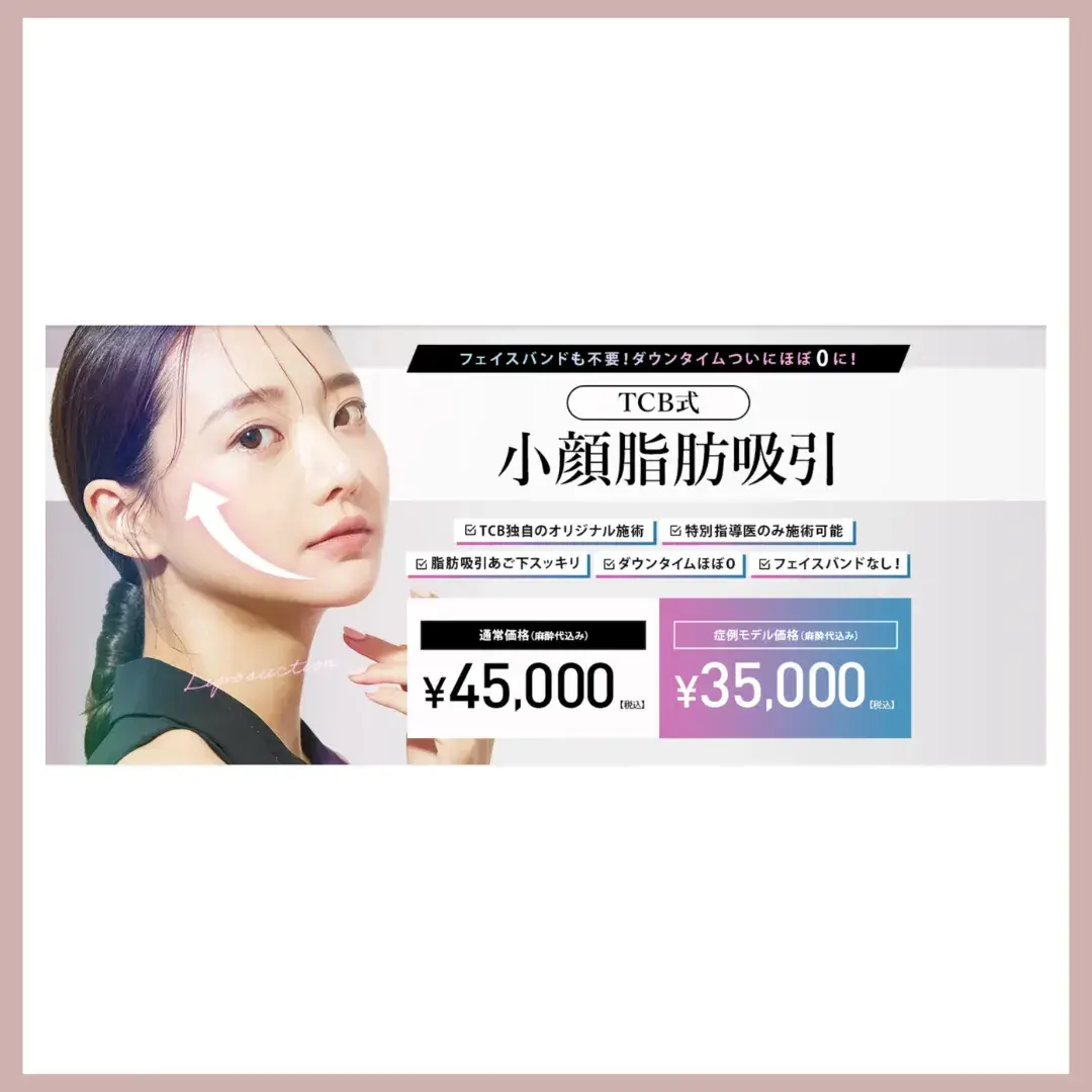 TCB医療ダイエット(小顔脂肪吸引)バナー