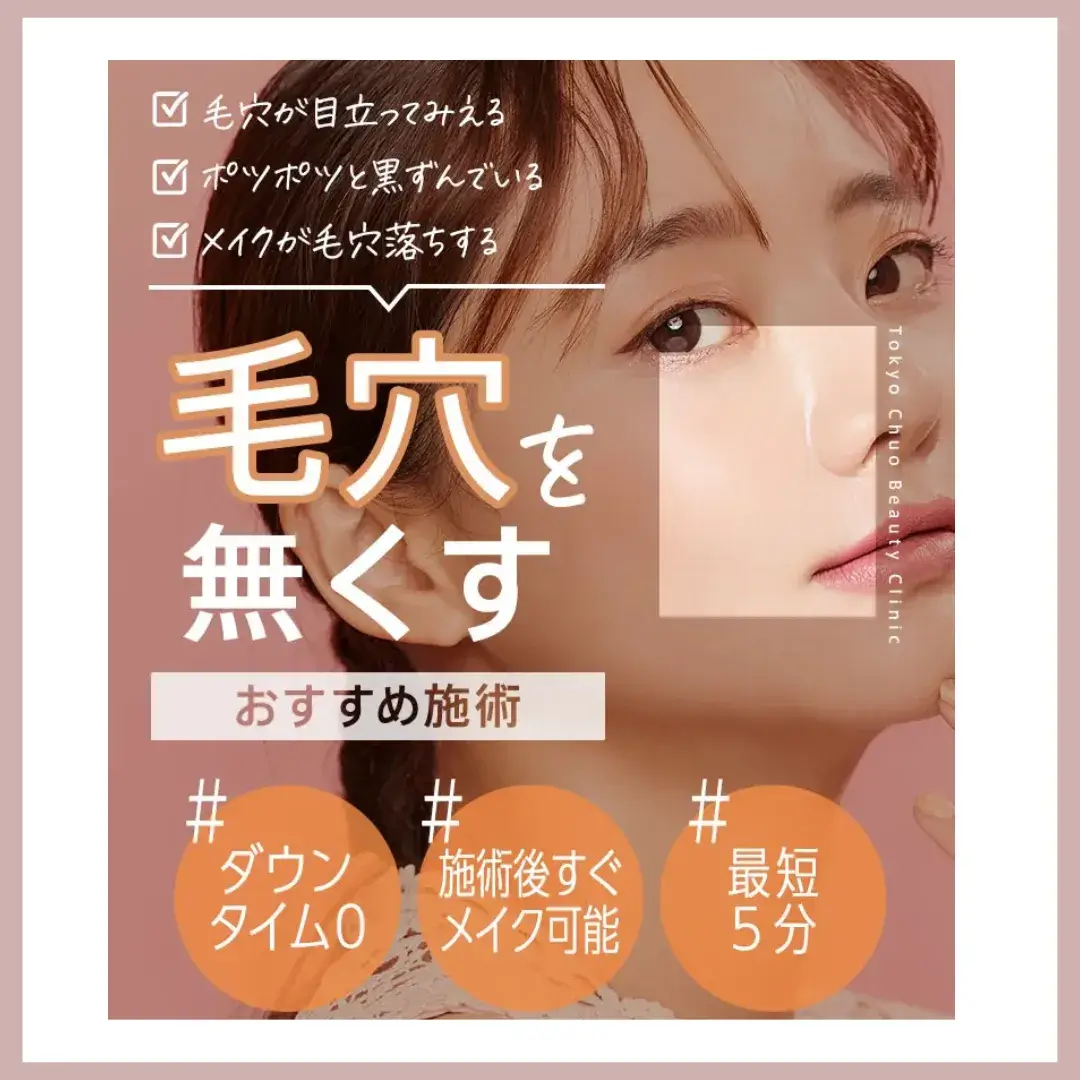 毛穴治療 おすすめ