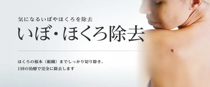 東京美容外科ホクロ除去LP