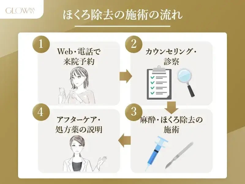 ほくろ除去施術の流れ
