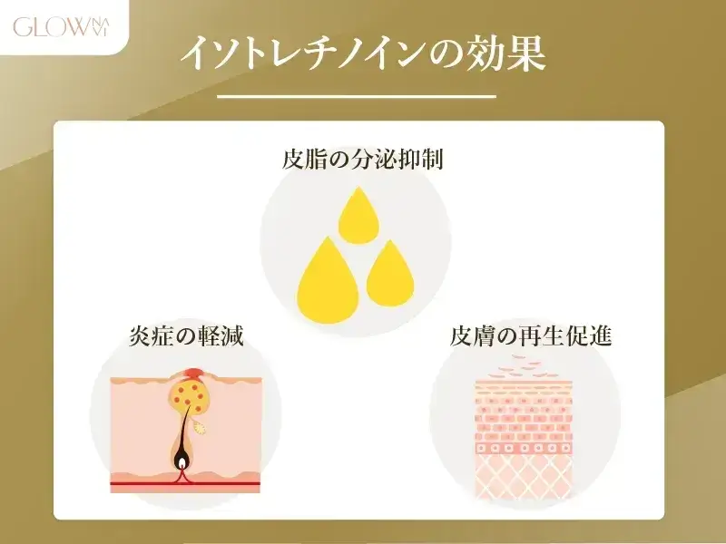 イソトレチノインの効果