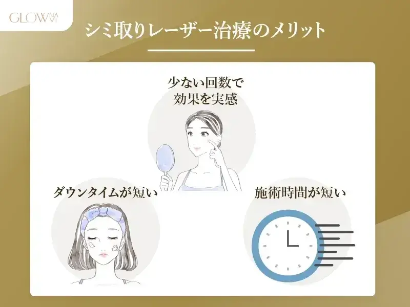 シミ取りレーザーのメリット