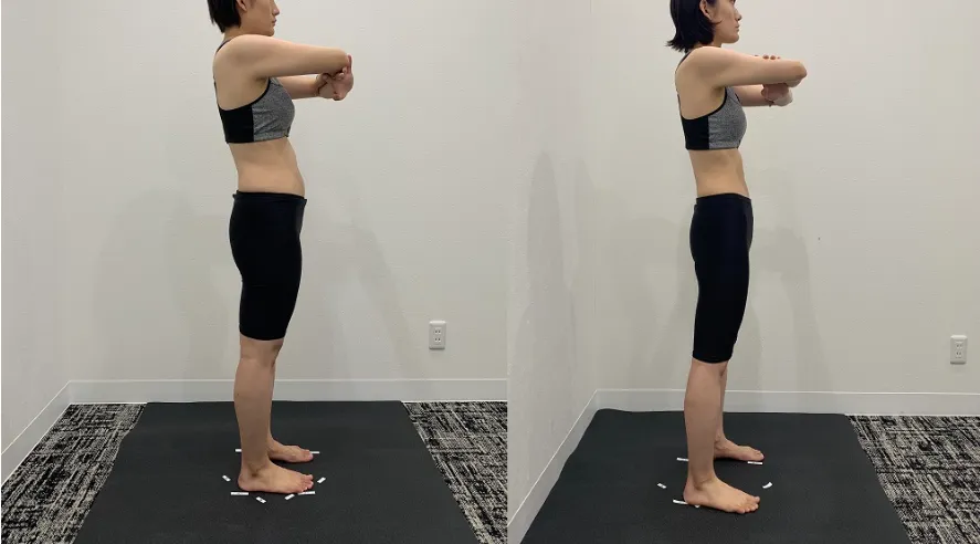 DIOクリニック ダイエット症例