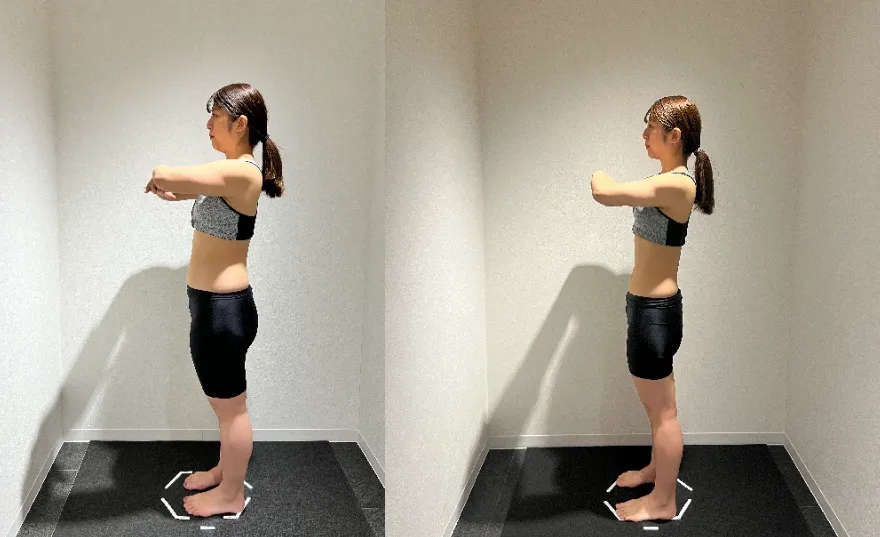 DIOクリニック ダイエット症例