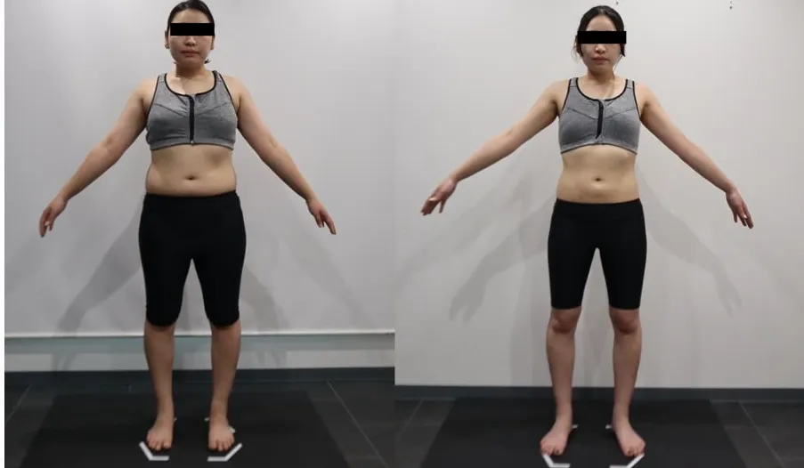 DIOクリニック ダイエット症例