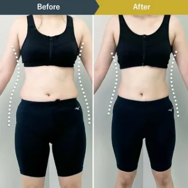 BSクリニック ダイエット症例