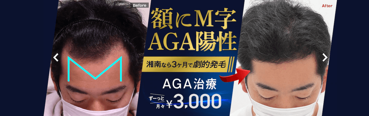 湘南AGAクリニック