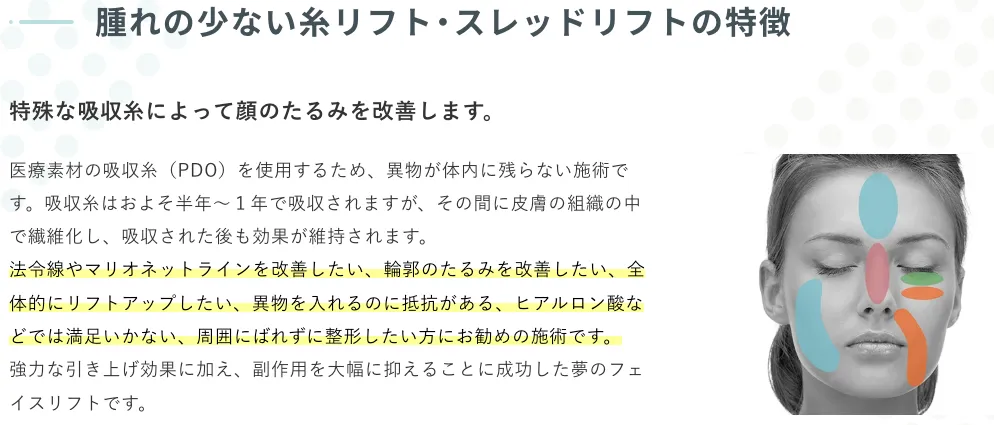 銀座よしえ　糸リフト　