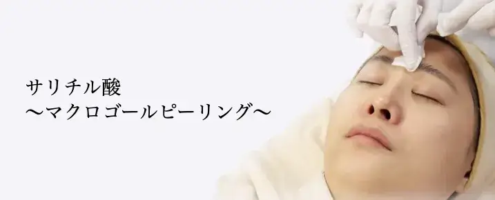 共立美容外科 ケミカルピーリング