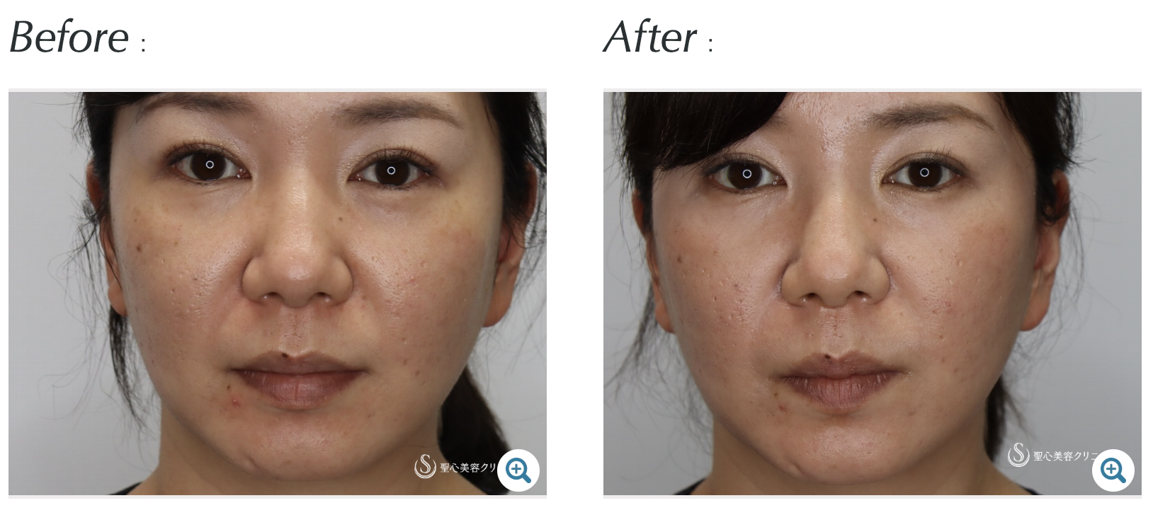 聖心美容クリニック