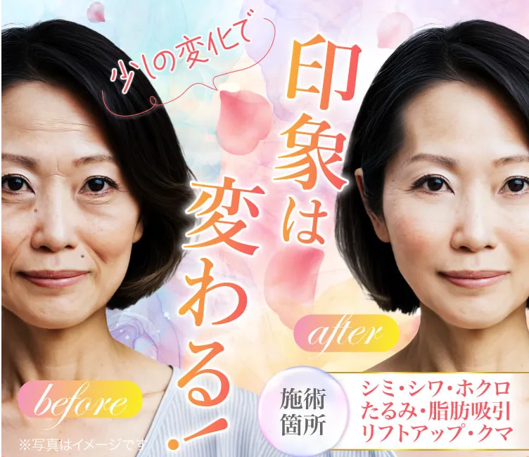 TCB東京美容外科