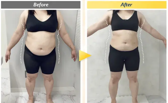 エミナルクリニック医療ダイエットの結果