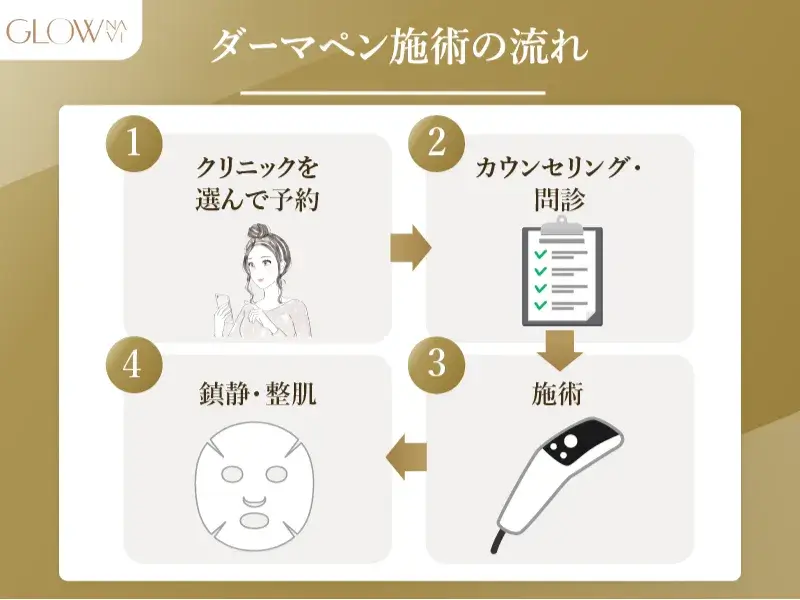 ダーマペン施術の流れ
