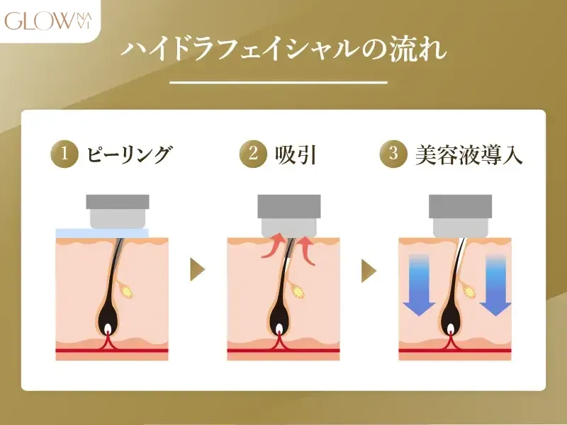 ハイドラフェイシャルの流れ 解説画像