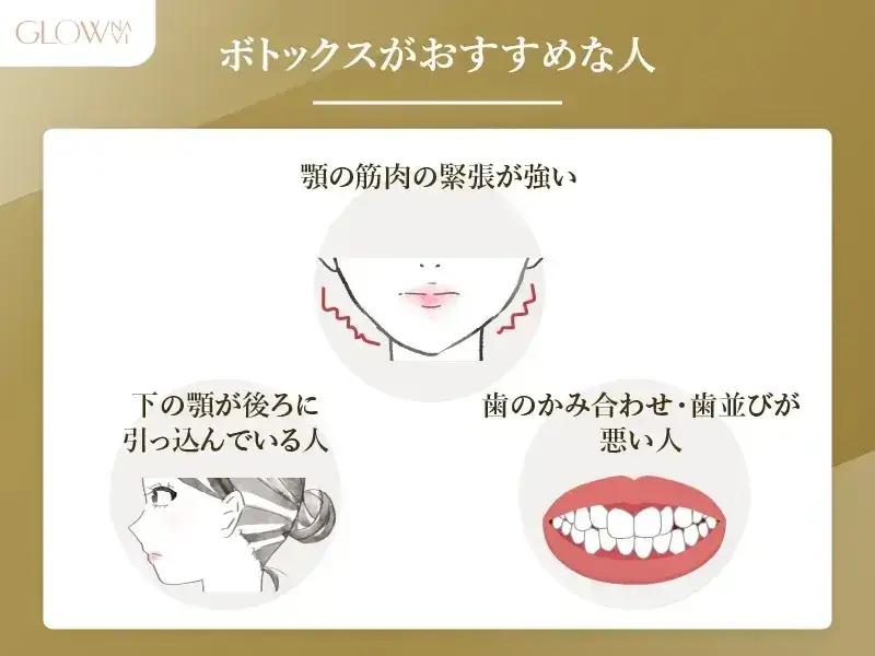 ボトックスがおすすめな人